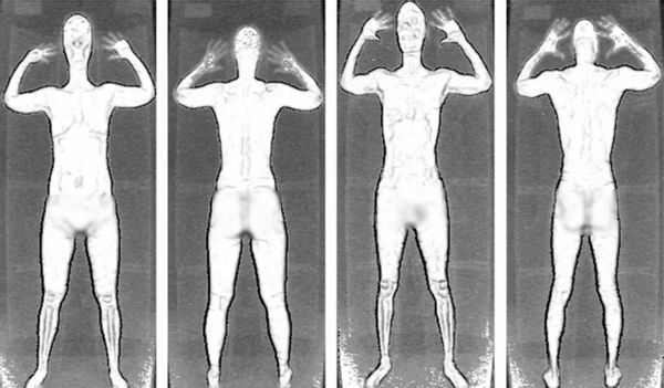 TSA body scans
